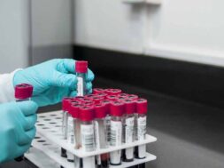 sangue-avis-donazione