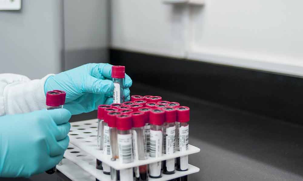 Emergenza donazioni sangue: l’autoemoteca Avis torna in campo il 31 marzo.